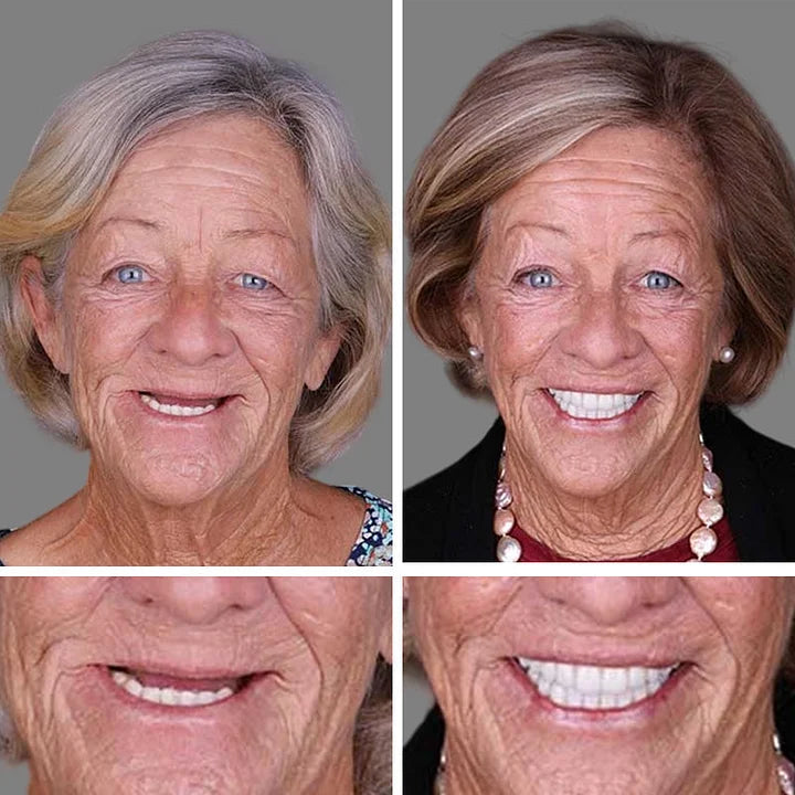 ⚡ Ends Today: 50% OFF! Smile More Comfortably Again
