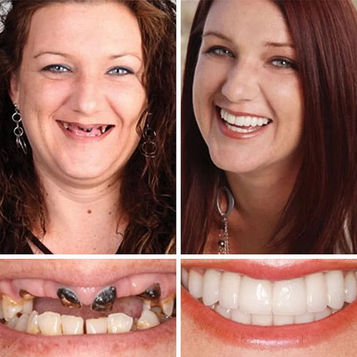 ⚡ Ends Today: 50% OFF! Smile More Comfortably Again