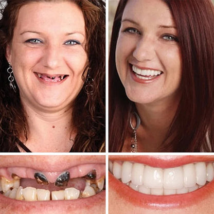 ⚡ Ends Today: 50% OFF! Smile More Comfortably Again