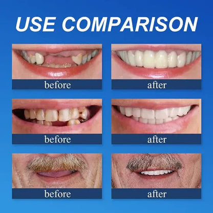 ⏰ Ends Today: 50% OFF! 🌎 KLENIMORE™ Daily Smile Confidence Set — Natural Look, Easy Everyday Wear
