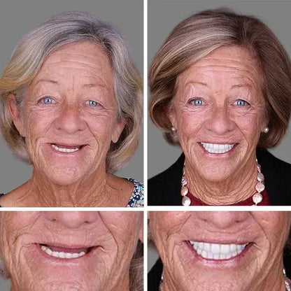 ⏰ Ends Today: 50% OFF! 🌎 KLENIMORE™ Daily Smile Confidence Set — Natural Look, Easy Everyday Wear